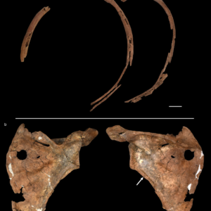 Ribs and front and back views of Shanidar A’s shoulder blade, showing a round perforation.