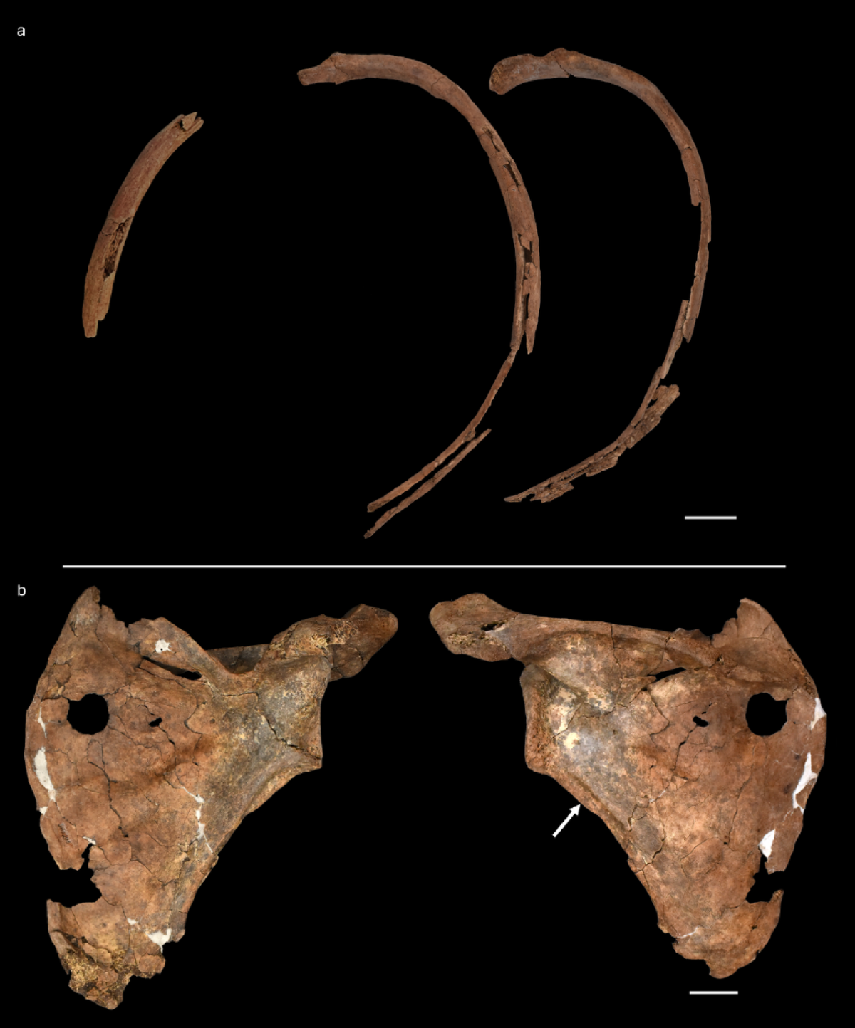 Ribs and front and back views of Shanidar A’s shoulder blade, showing a round perforation.